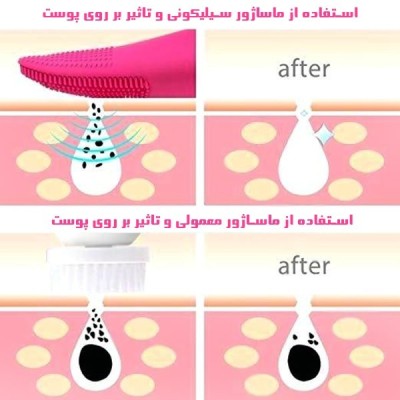 ماساژور و تمیز کننده صورت سیلیکونی ماساژور و تمیز کننده صورت سیلیکونی